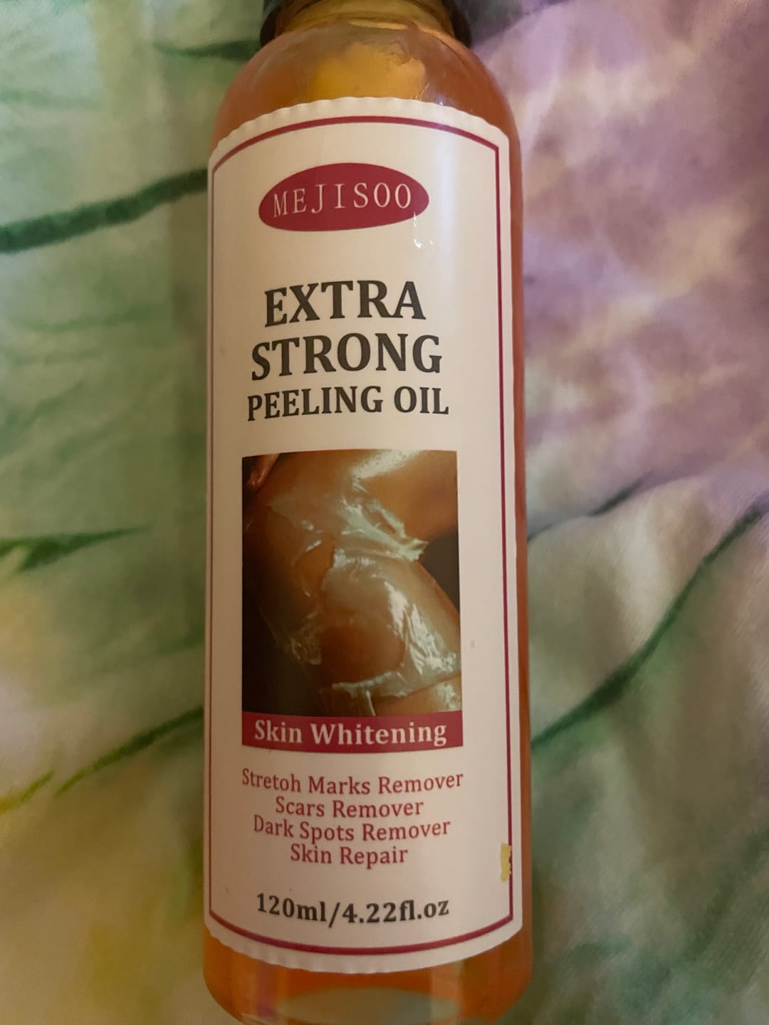 Customer photo review of Orange Peeling oil - exfoliating skin |Repair stretch mark