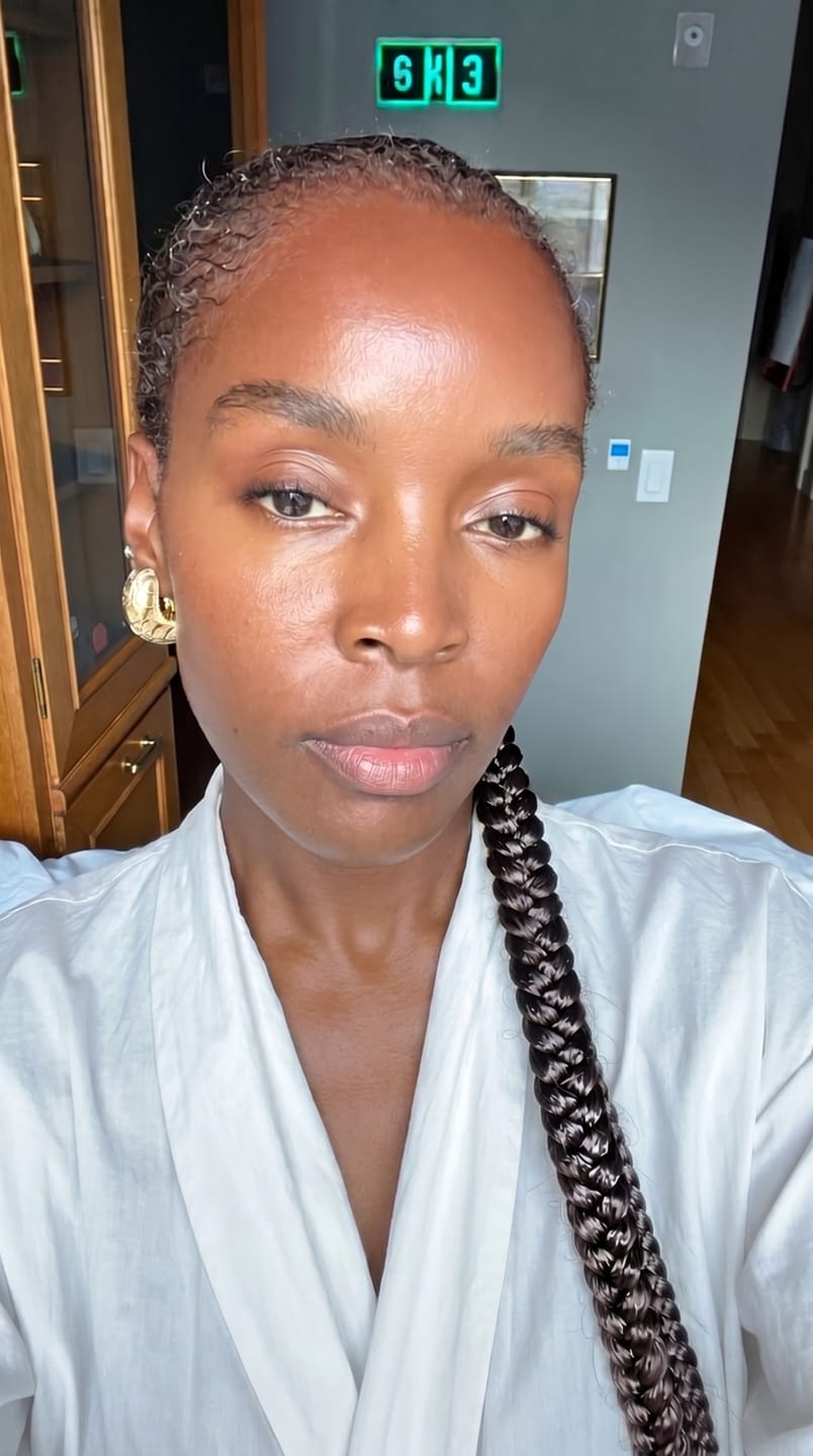 Customer photo review of The Micro Infusion System™ For Melanin-Rich Skin