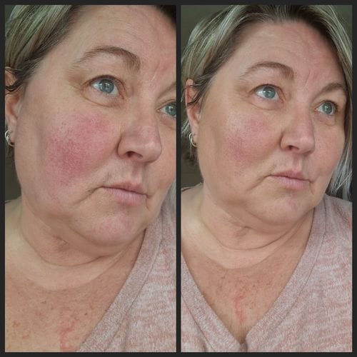Customer photo review of GRATIS samples – exclusief voor nieuwe klanten
