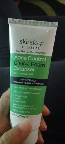 Customer holding a white and green tube of the skindeep Acne Control Clay-to-Foam Cleanser.