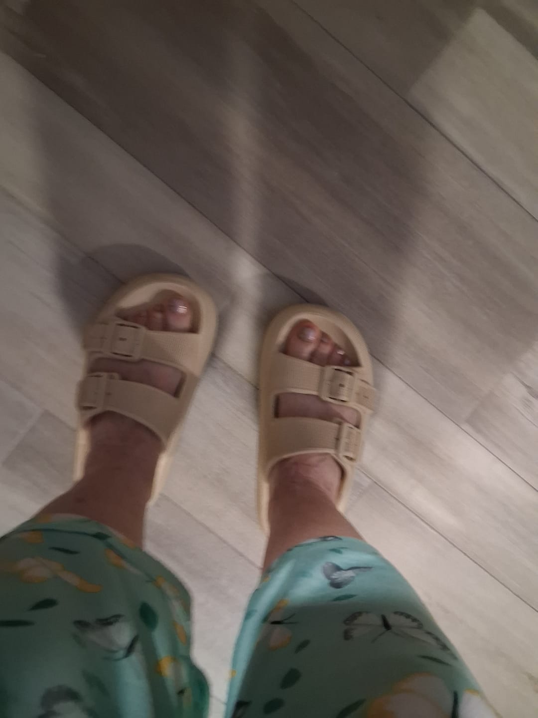 Customer photo review of Cloud Slides - Cushioned EVA Sandals with Adjustable Buckles