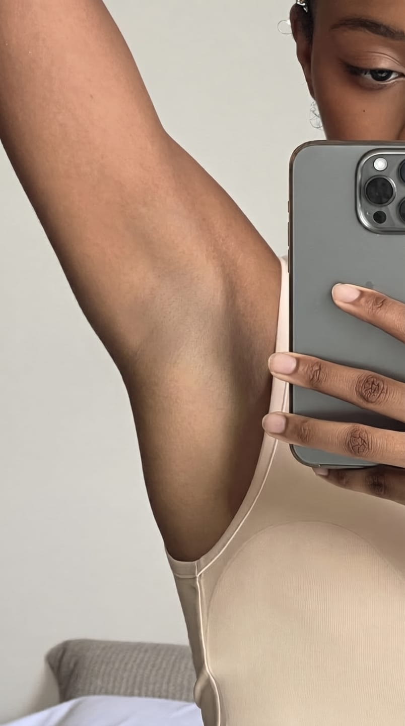 Customer photo review of The Micro Infusion System™ For Melanin-Rich Skin