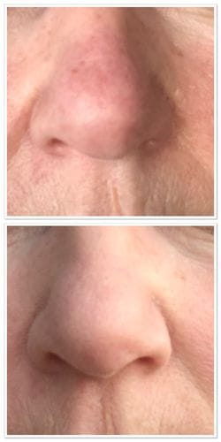 Customer photo review of GRATIS samples – exclusief voor nieuwe klanten
