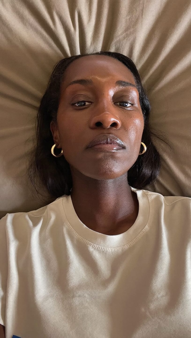 Customer photo review of The Micro Infusion System™ For Melanin-Rich Skin
