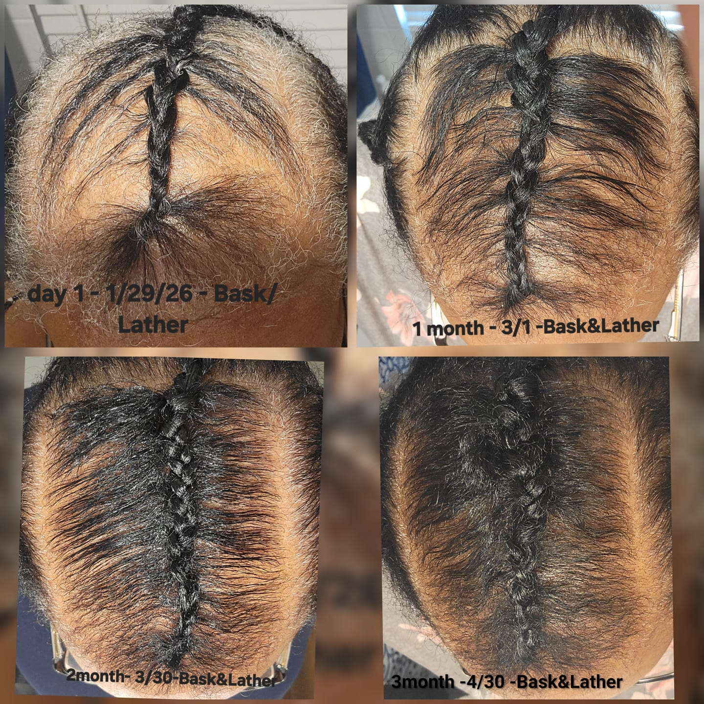 Customer photo review of Healthy Hair Starter Kit- Limited Edition