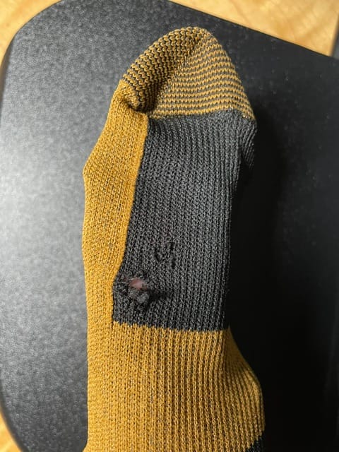 Customer photo review of Copper Compression Socks (3-Pack)