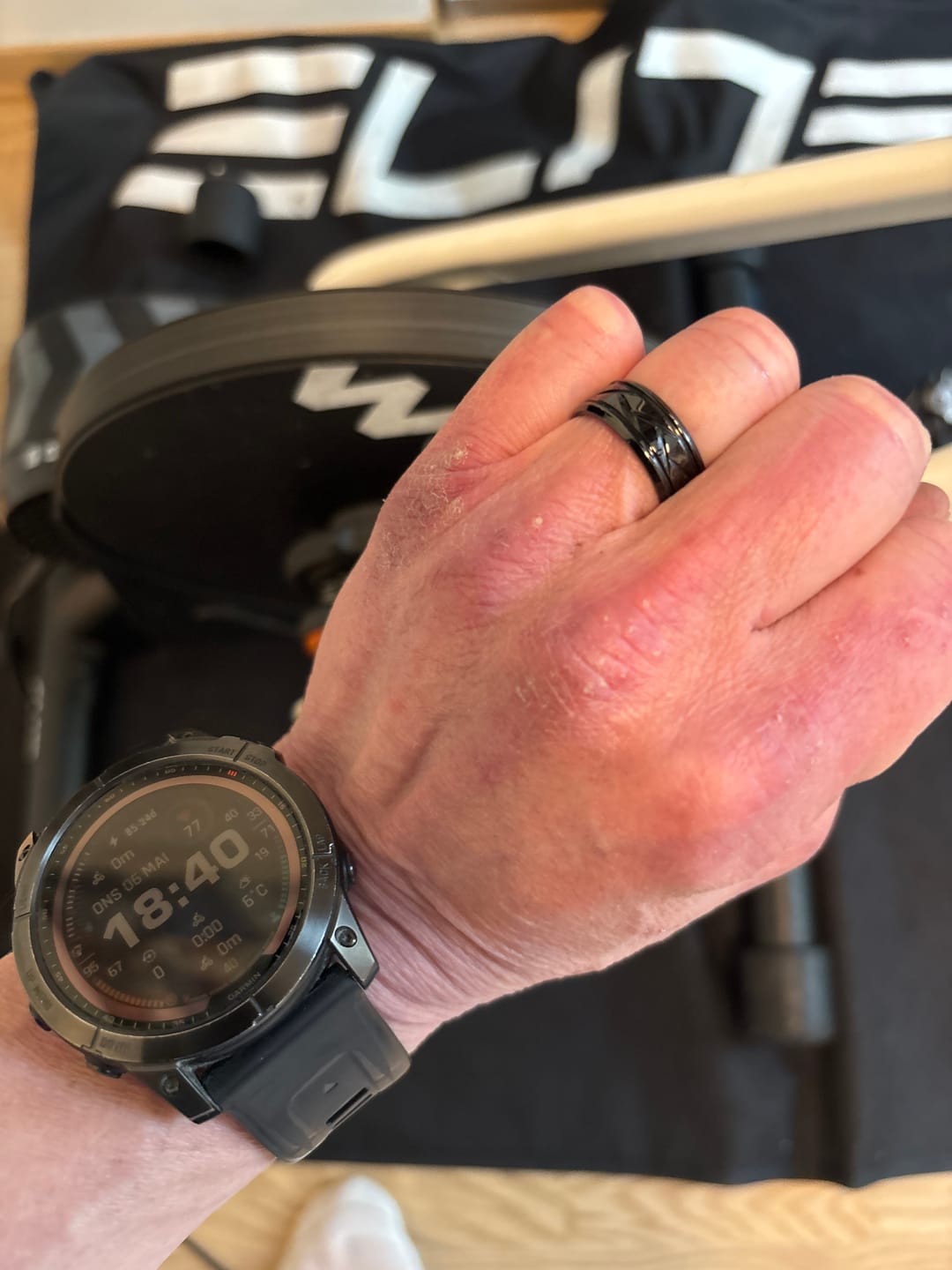 Customer photo review of Cycolinks 8mm Titanium Steel Tire Ring BOGOF