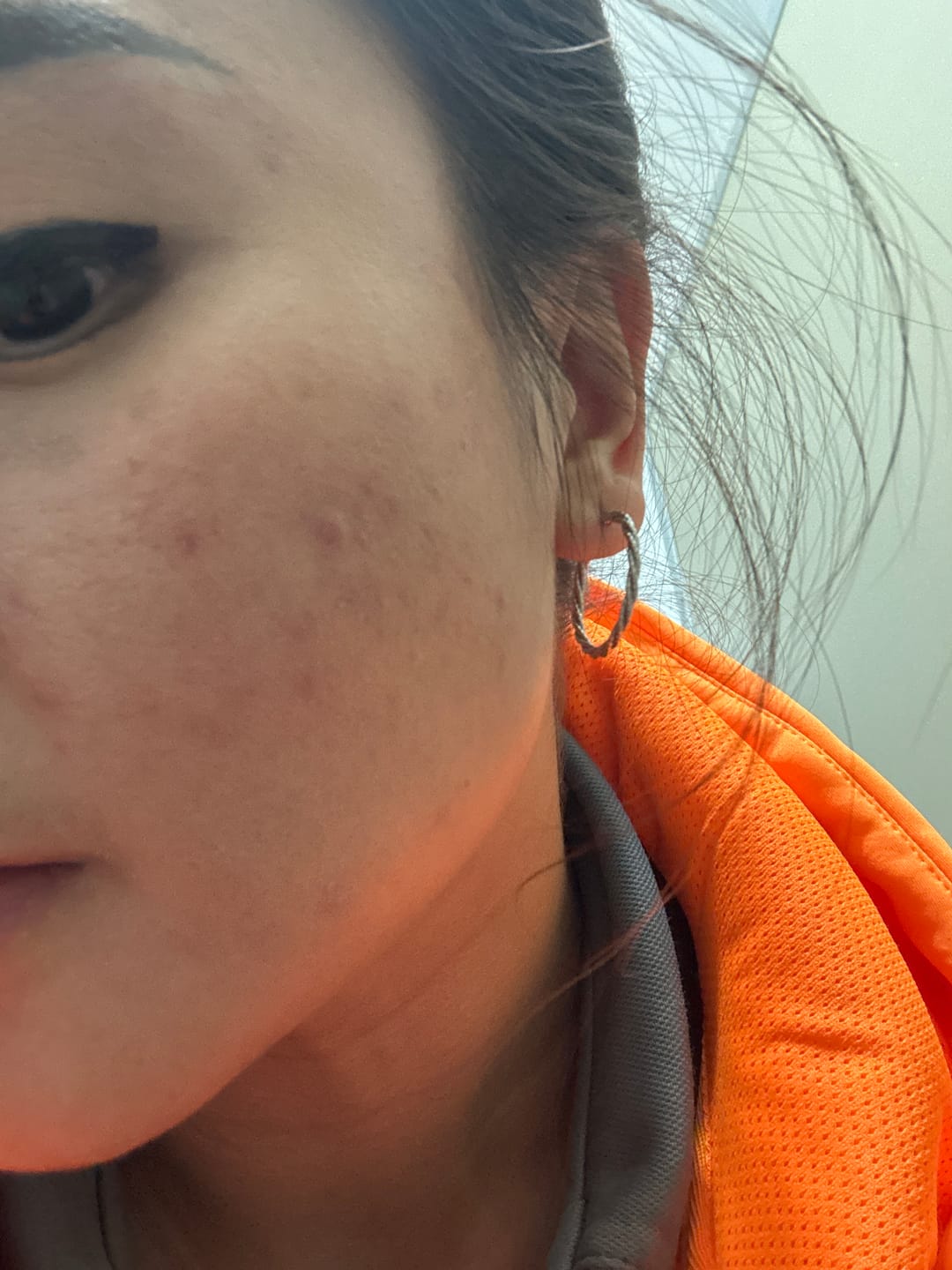Customer photo review of Skin Clearing Serum