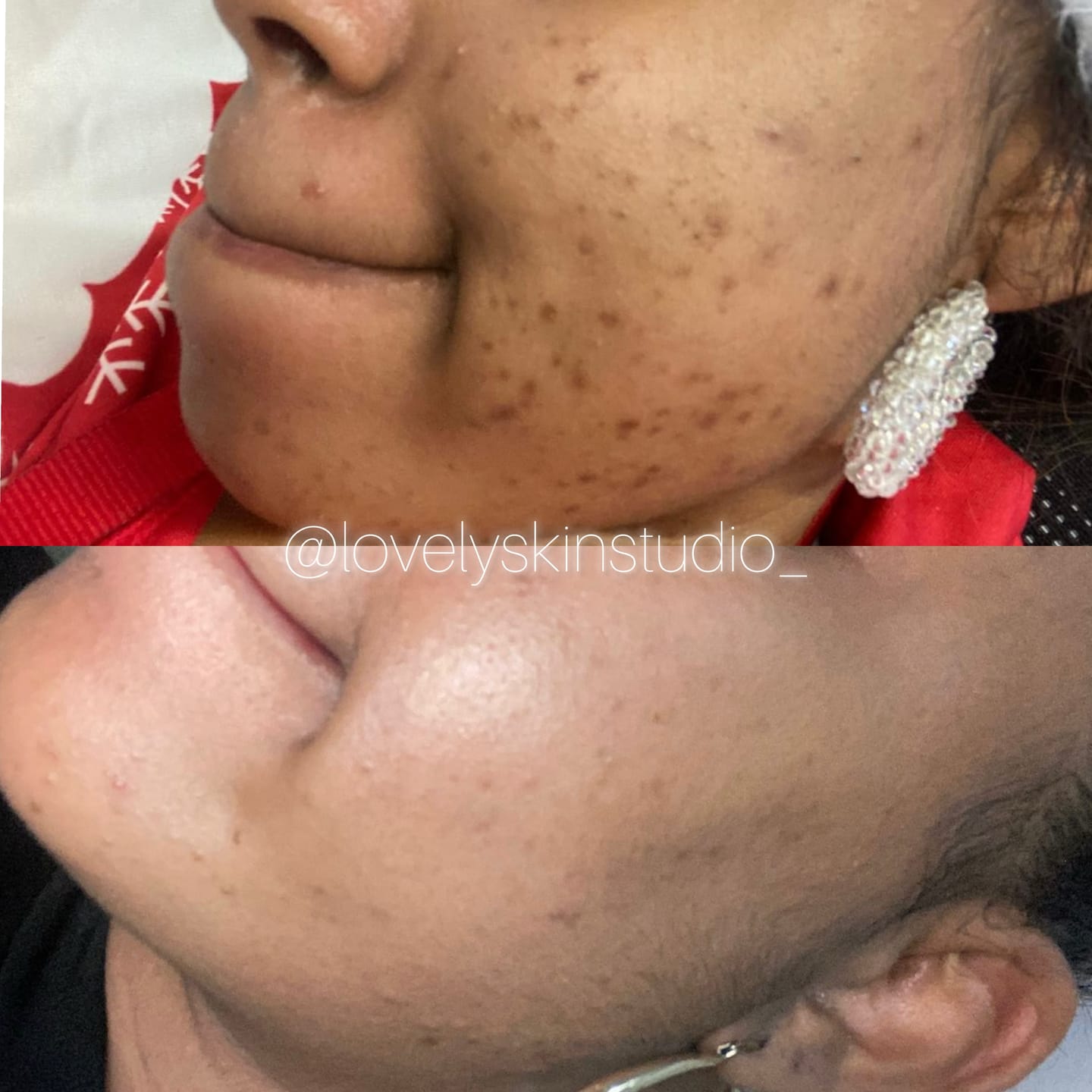 Customer photo review of Zena 100% Organic Algae Peel
