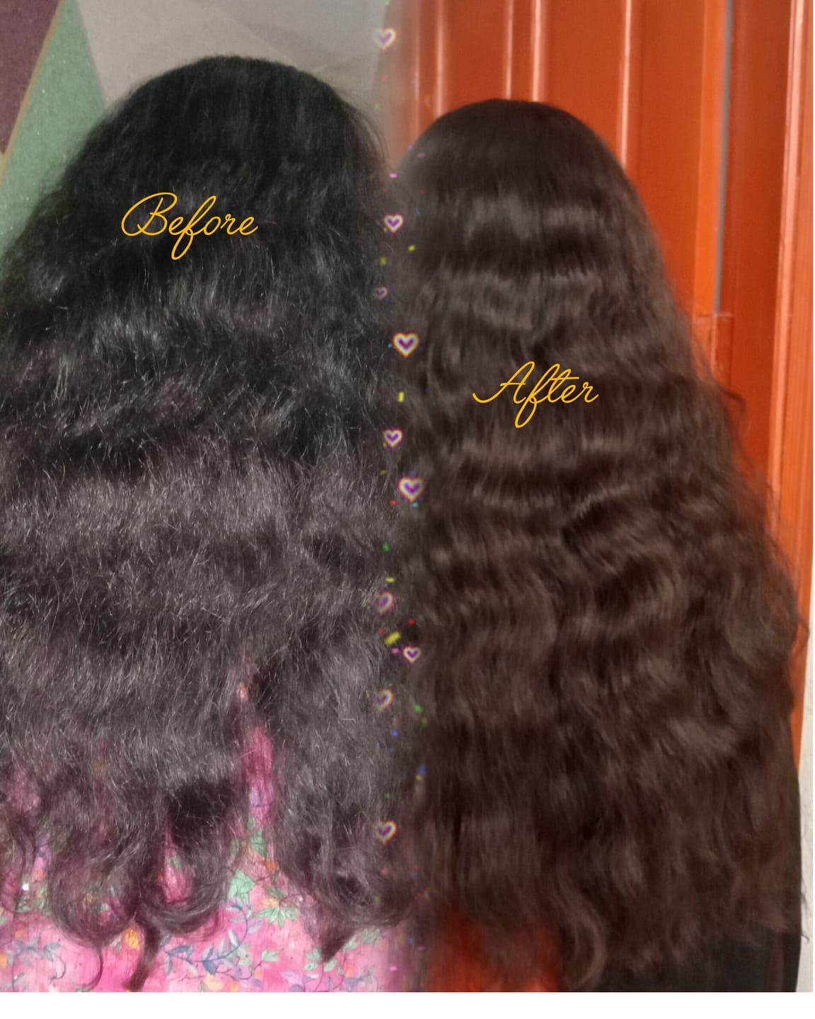 Customer photo review of ZERO HAIRFALL DUO