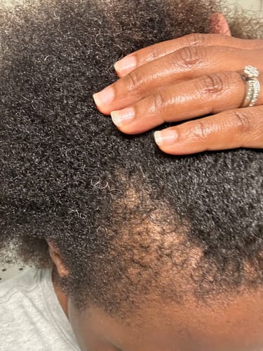 Customer photo review of Natural Hair Growth Oil