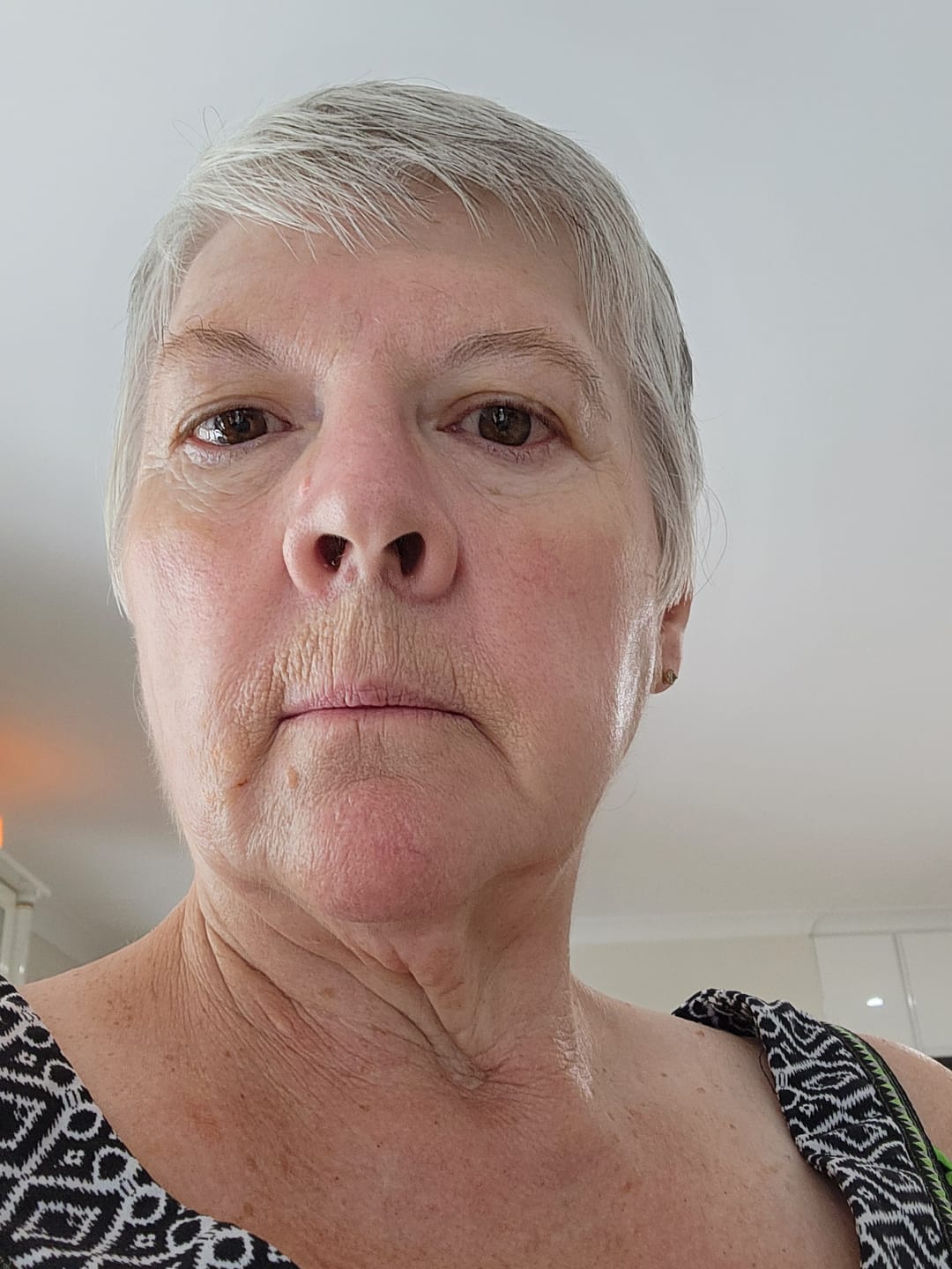 Customer photo review of Koriderm™ Time Reverse Cream (All-In-One)