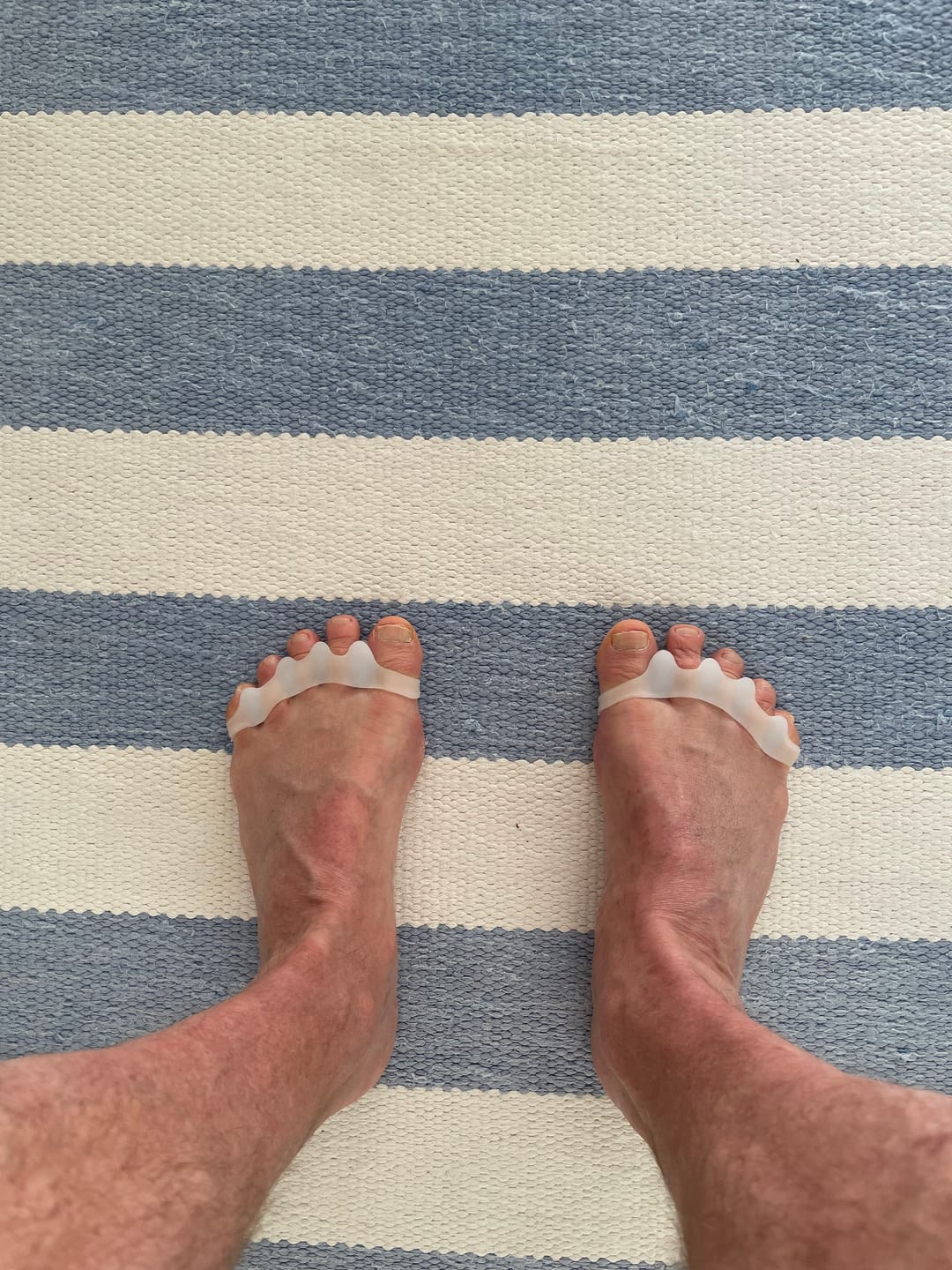 Customer photo review of Vaistoa Varpaiden Erottajat