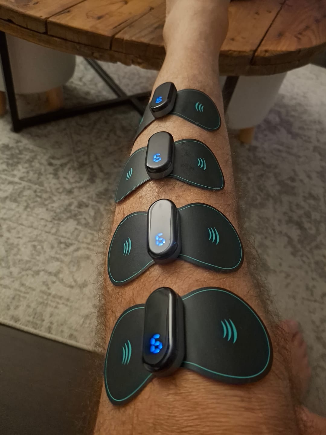 Customer photo review of Vibit TENS - Electrical Nerve Stimulation Therapy