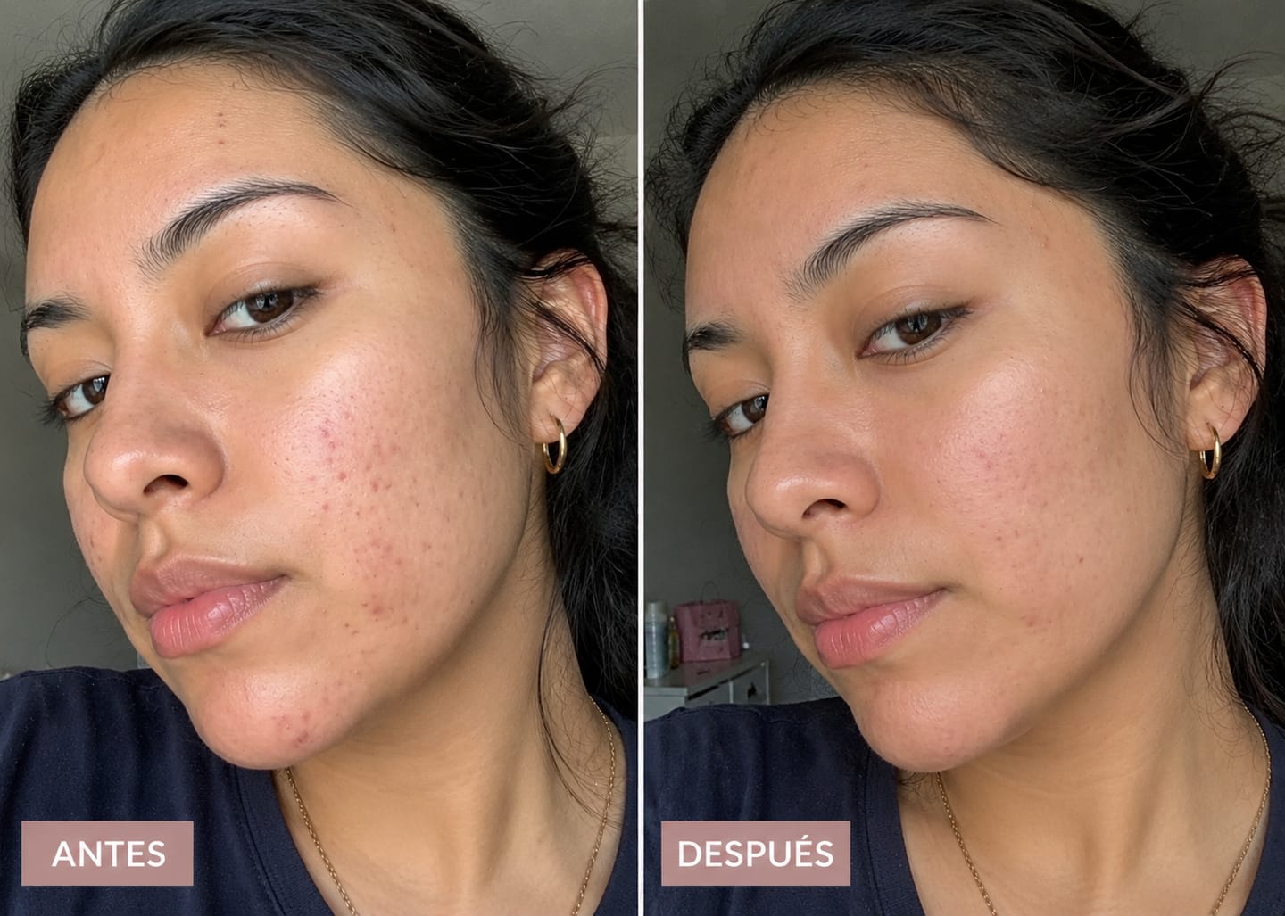 Customer photo review of Nutryself ® (Colágeno-Ácido hialurónico)
