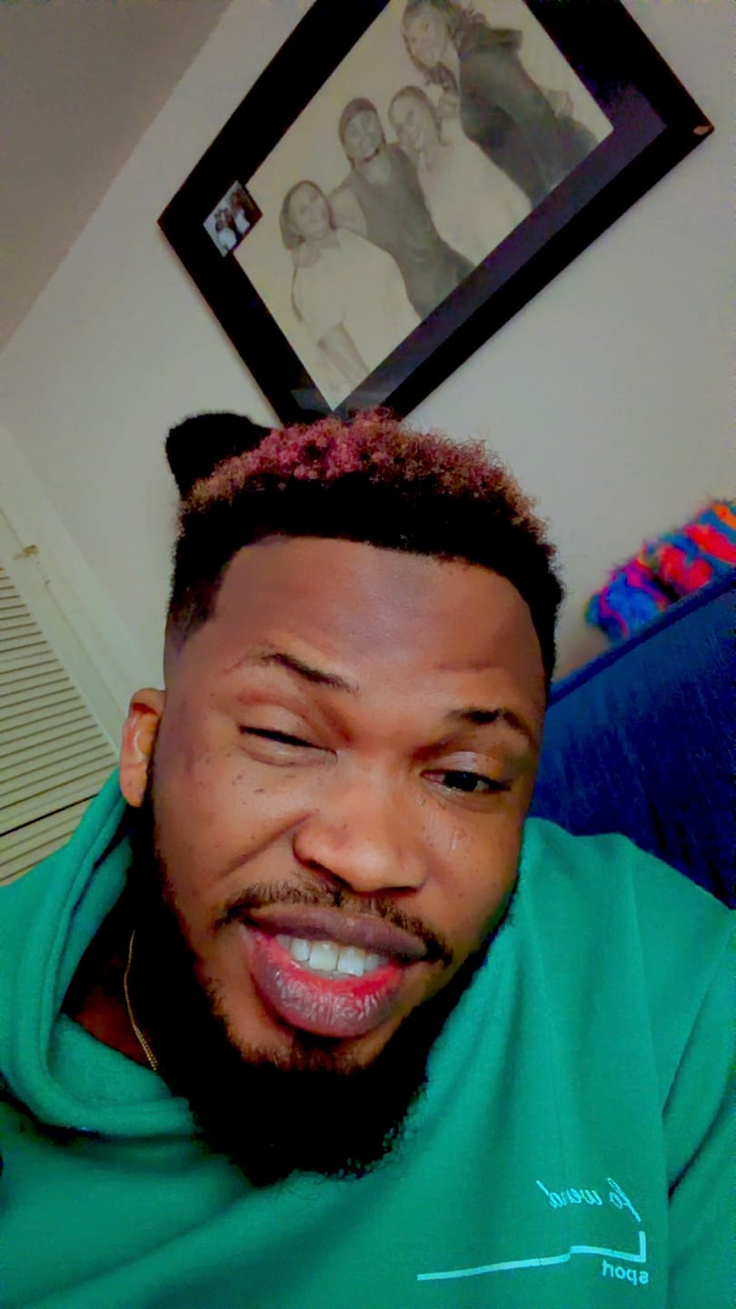 Customer photo review of Lips Lightening Cream For Men and Women (Results in 5 Days or Less)