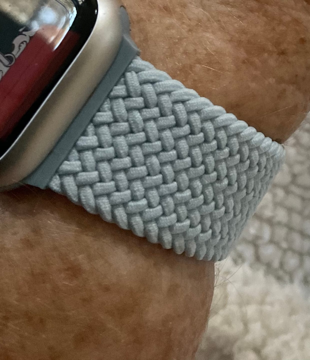 Customer photo review of FlexiFit™ Braided Magnetic Band - BUY 1 GET 1 FREE!