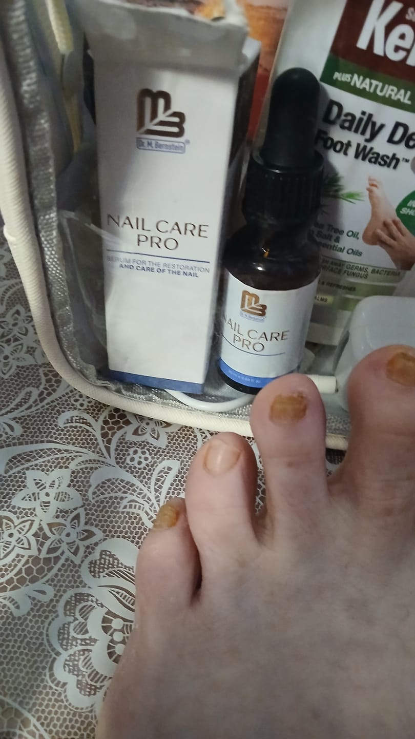 Customer photo review of Nail Strengthener and Growth Serum - Nail Care Pro