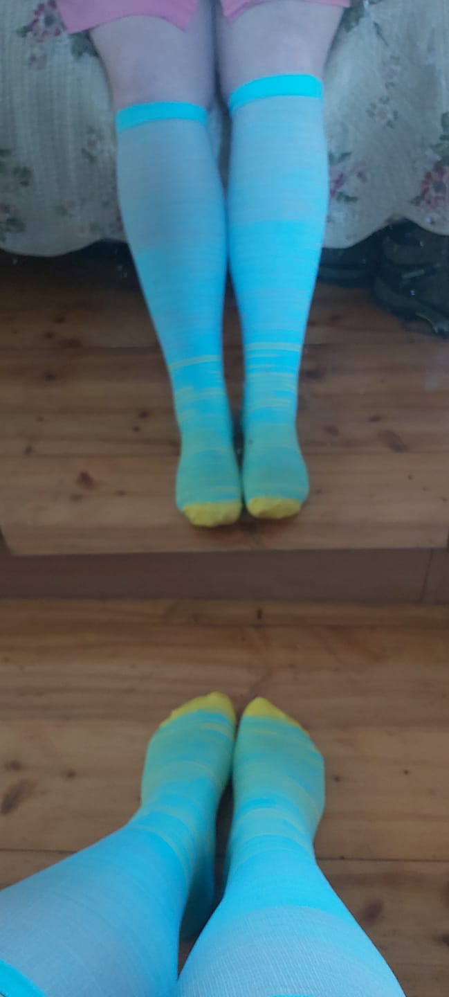 Customer photo review of EverSock™ Wide Compression Socks For Pain Relief (Stripes)