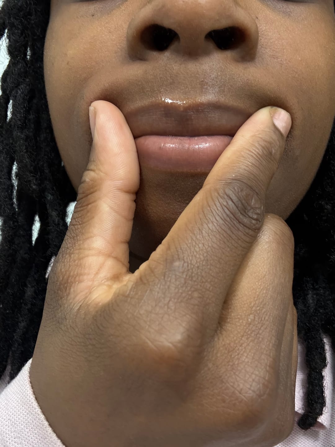 Customer photo review of Turmeric and Lemon Lip Balm (for Dark Lips)