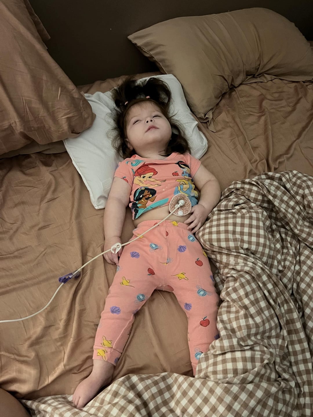 Customer photo review of Boho Feeding tube pads | AMT button pads | Mic-key button pads
