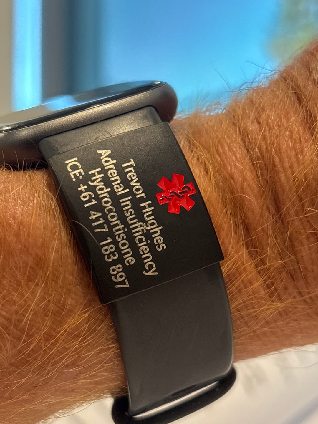 Customer photo review of Personalised ID Tag for Watch Band & Fitness Trackers