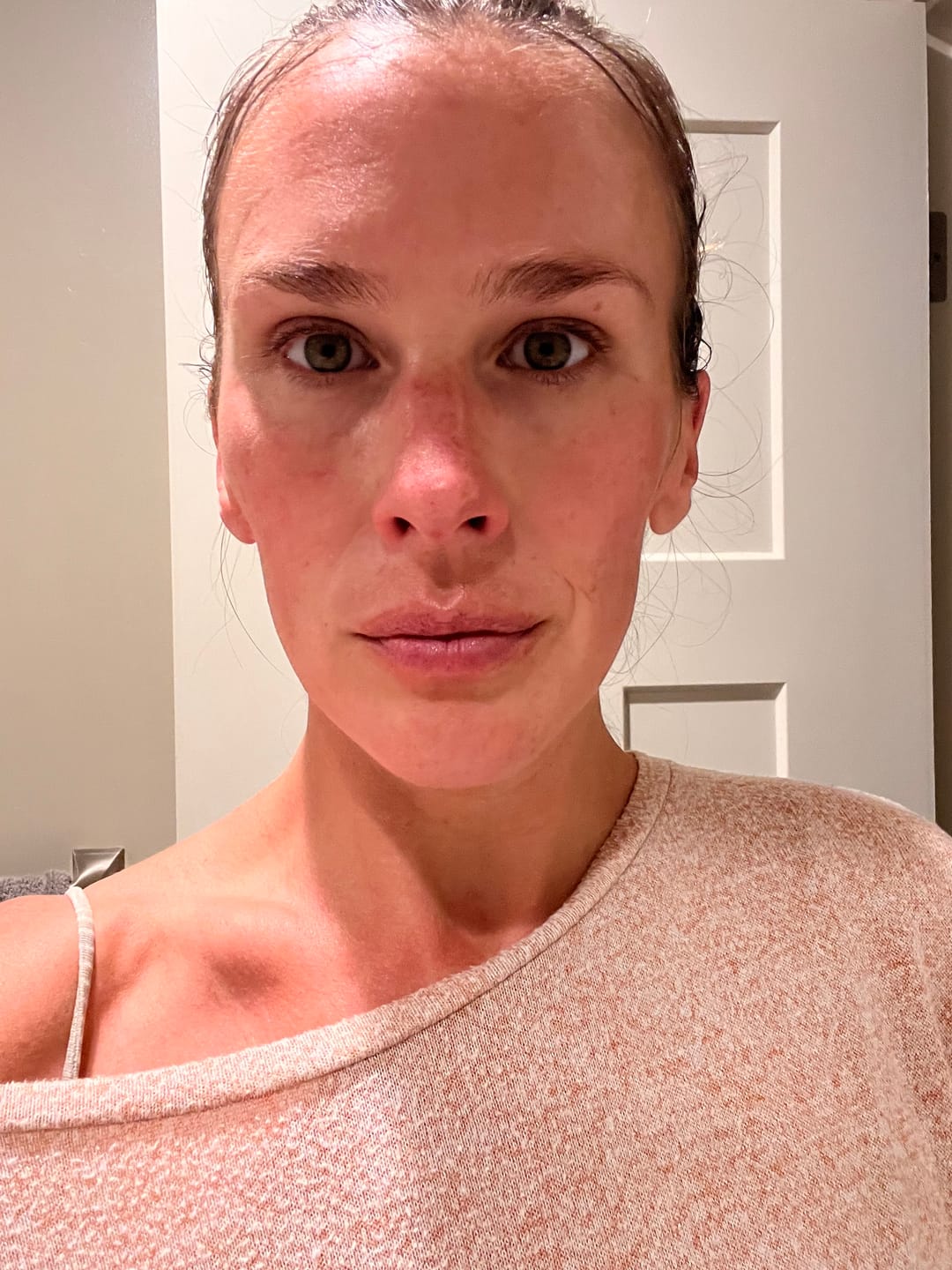 Customer photo review of F27 Superfat Ultra Hydrating Face Cream