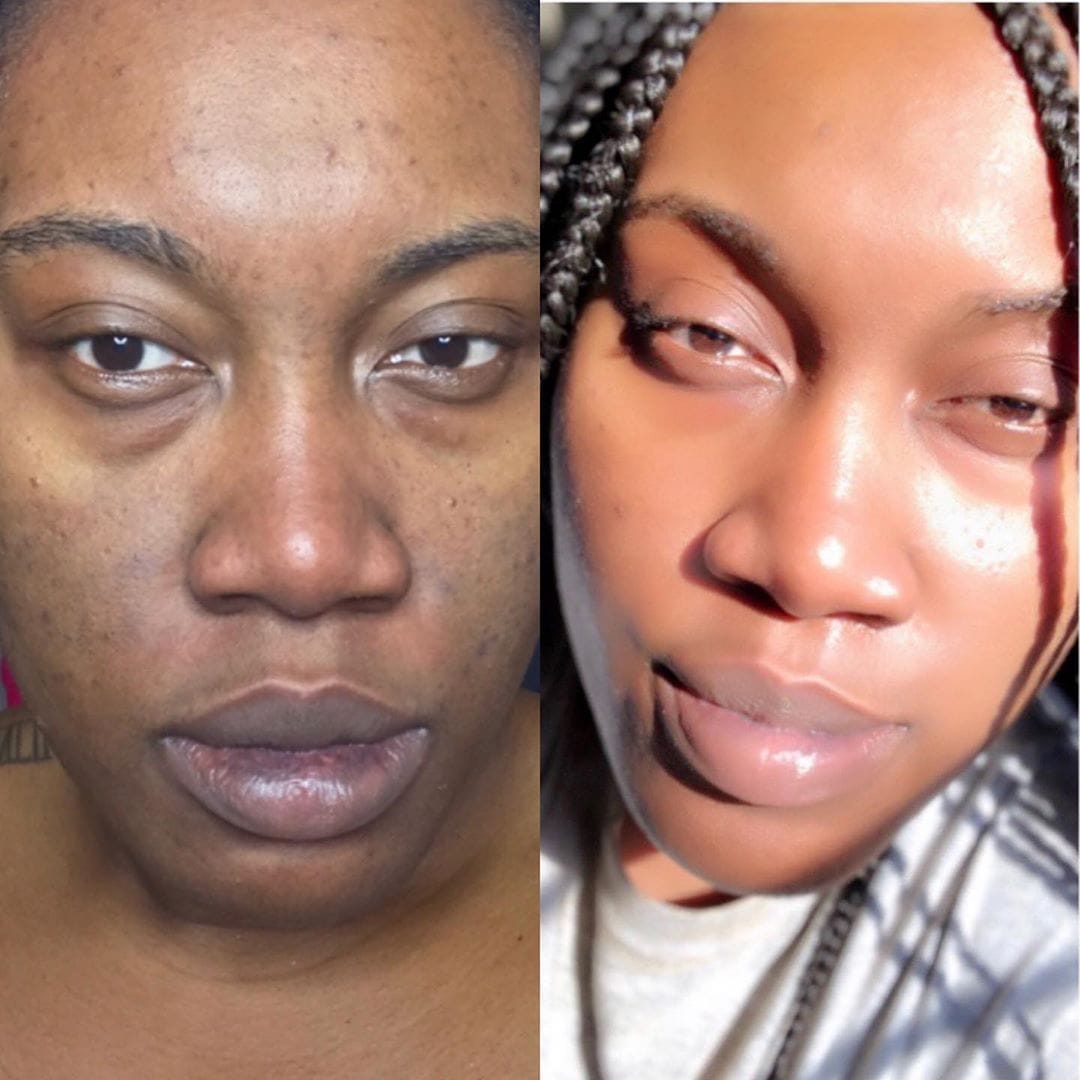 Customer photo review of Masque de nuit à l'acide kojique et au curcuma