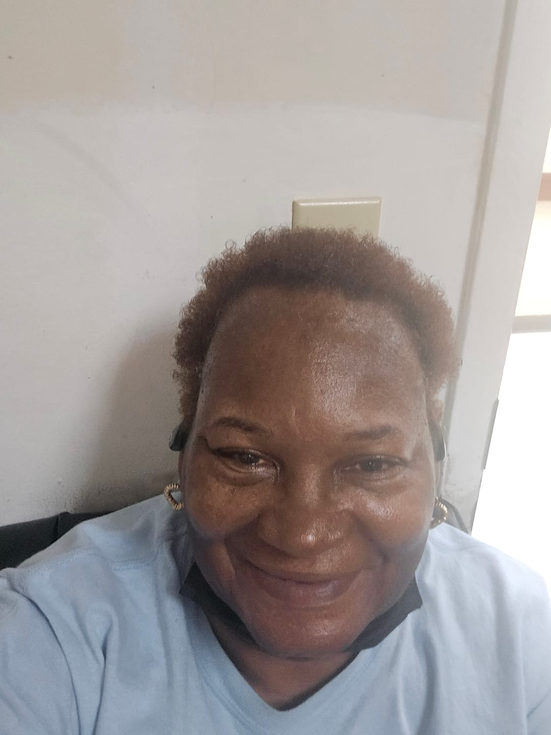 Customer photo review of Rennora Hair Growth Serum