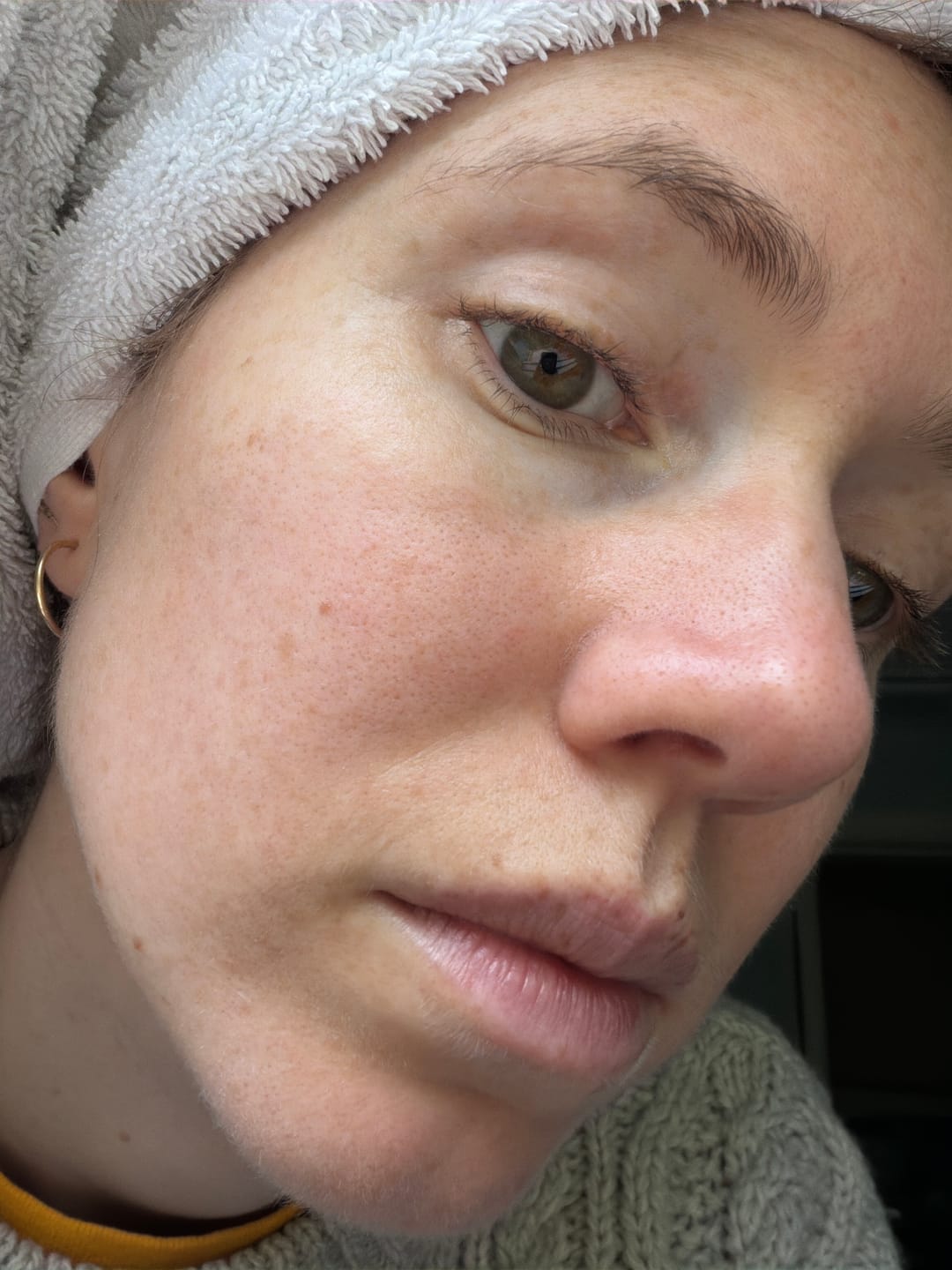 Customer photo review of Bolden Sunscreen Moisturizer | SPF 30 with Vitamin C, No White Cast