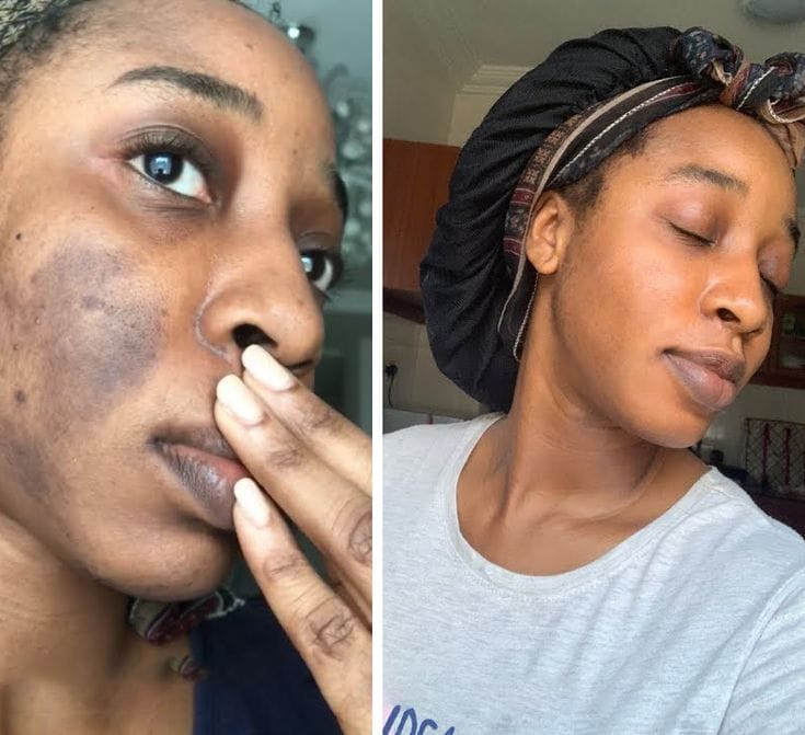 Customer photo review of Masque de nuit à l'acide kojique et au curcuma