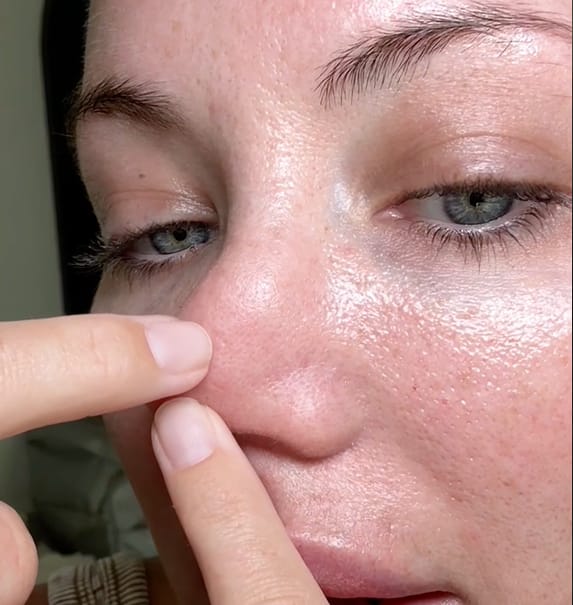 Customer photo review of PEEL SHOT | Оризова ампула