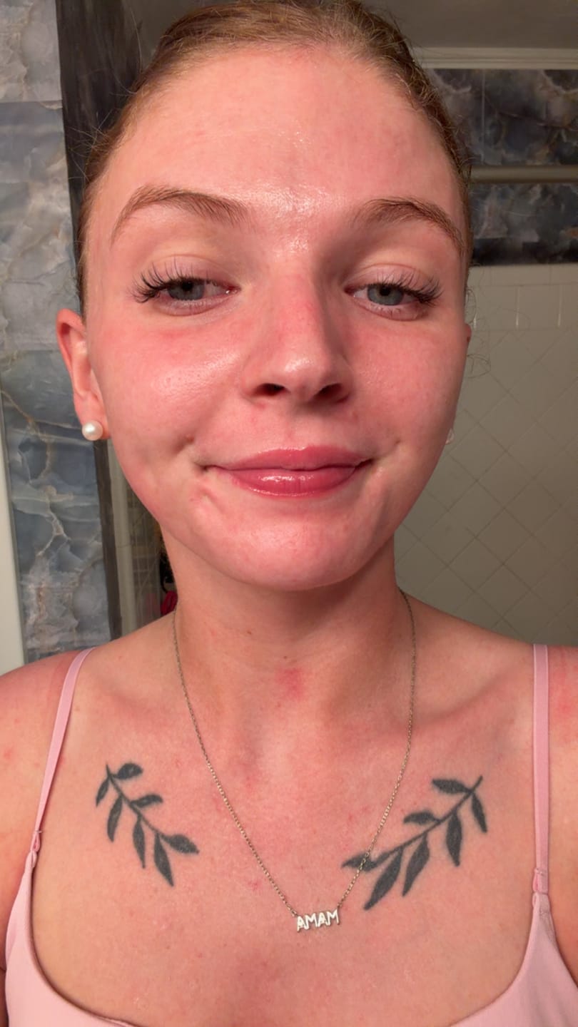 Customer photo review of CE SERUM | COMPLEXION BRIGHTENING