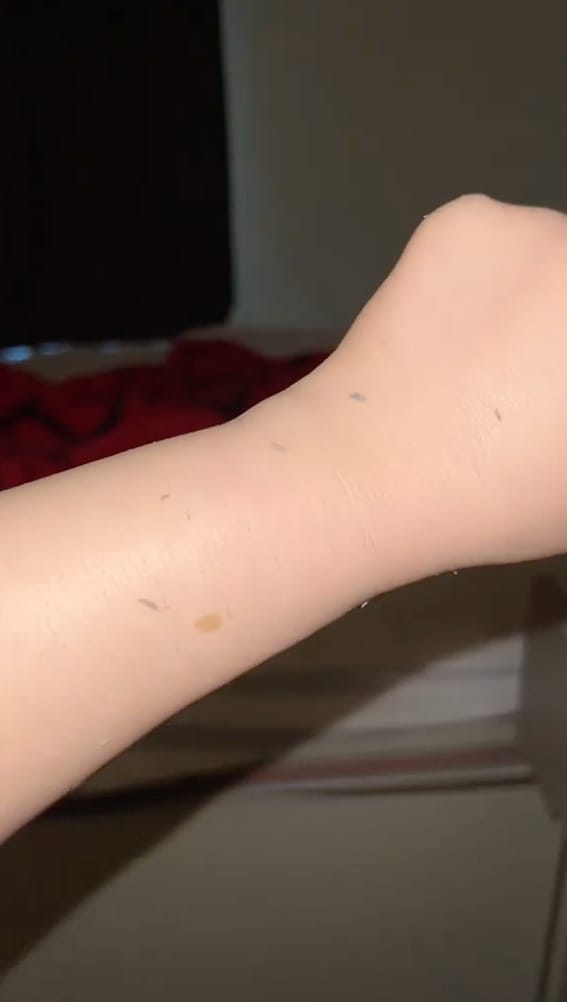 Customer photo review of PEEL SHOT | Оризова ампула
