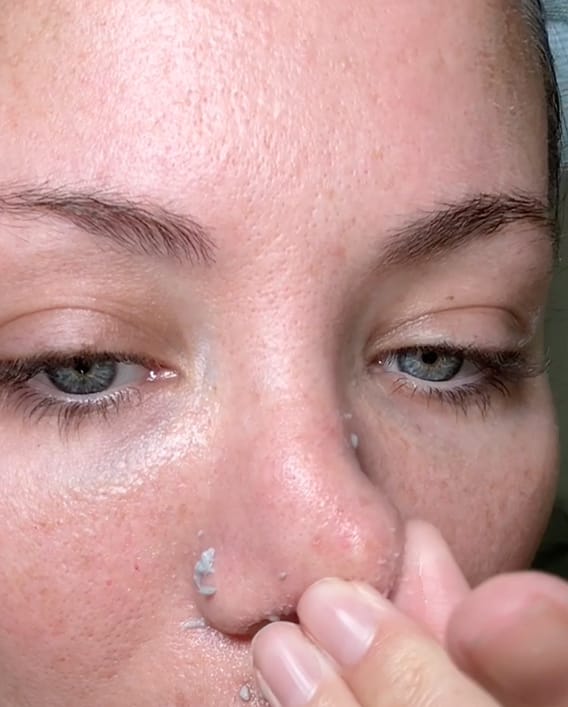 Customer photo review of PEEL SHOT | Оризова ампула