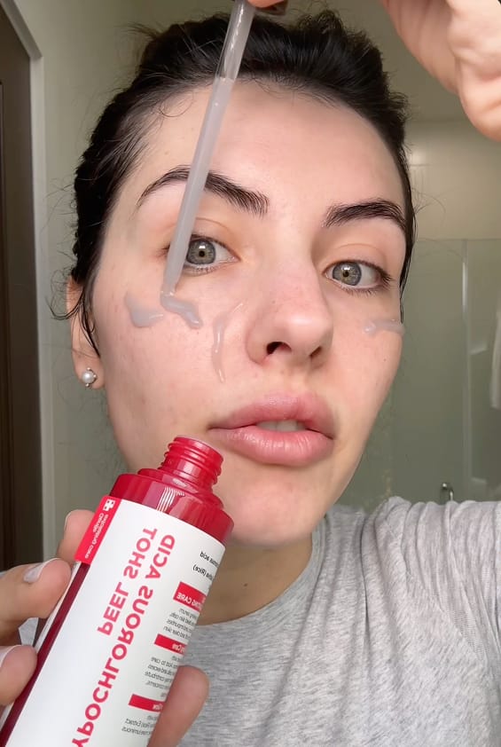 Customer photo review of PEEL SHOT | Оризова ампула