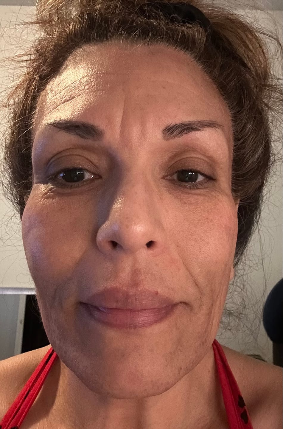 Customer photo review of Glov Micro Infusion System