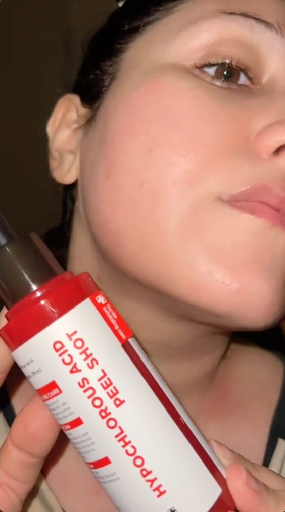 Customer photo review of PEEL SHOT | Оризова ампула