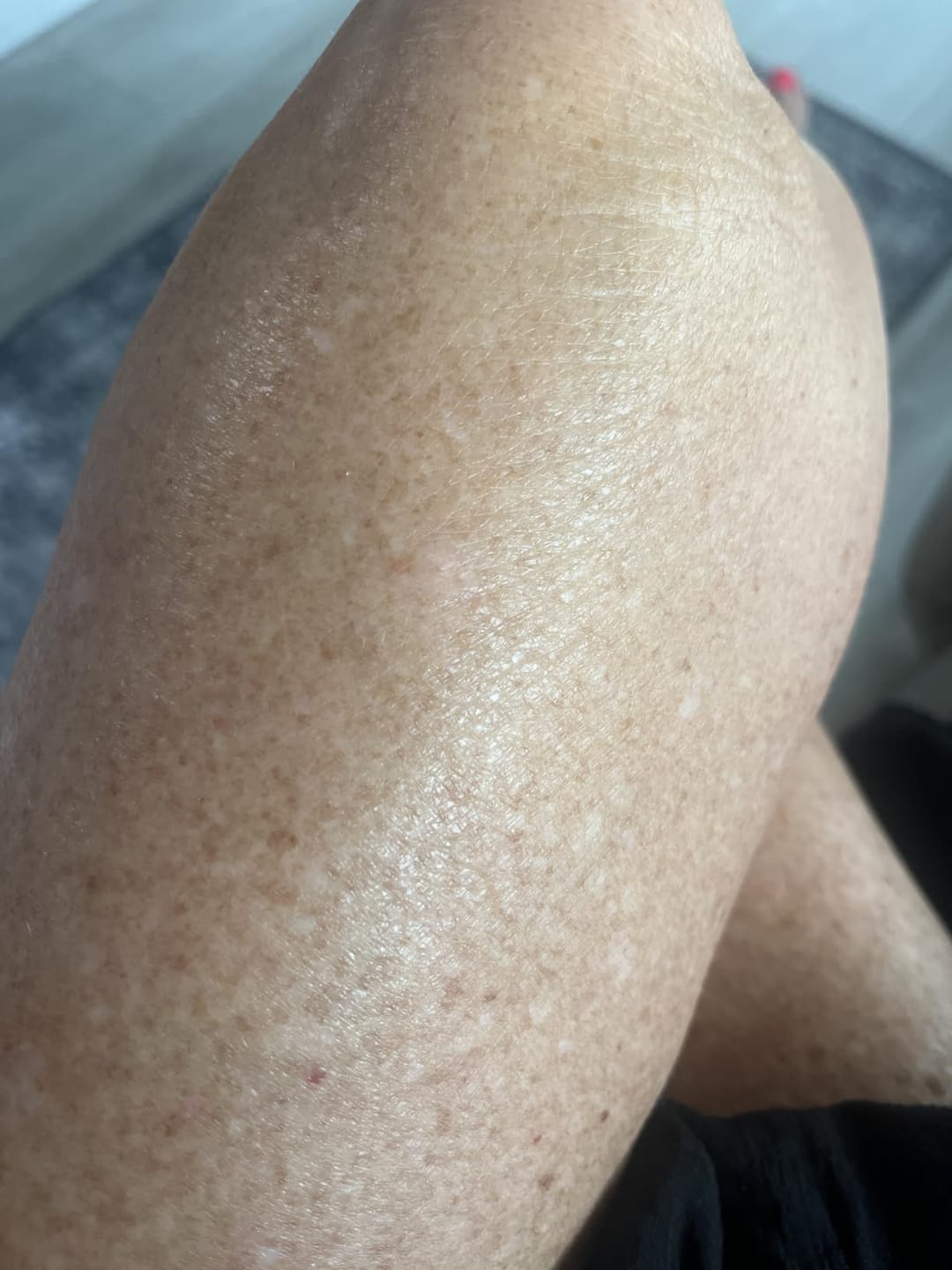 Customer photo review of NØRD BODY Peptide Body Oil