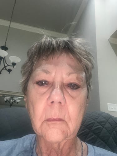 Reviewer's close-up photo of their face.
