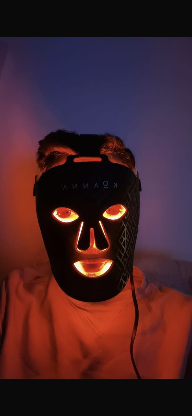 Customer photo review of Koanna® MultiGlo™ LED Light Therapy Mask