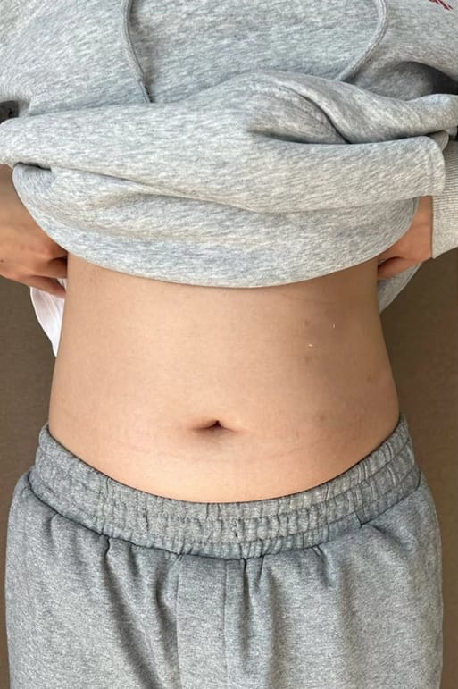 Customer photo review of INIA PULSE Red Light EMS Core Belt