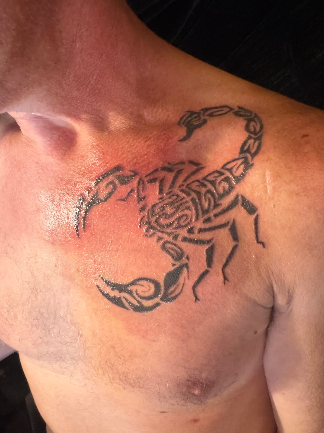 Customer photo review of Signature Tattoo Numbing Cream 1 TUBE
