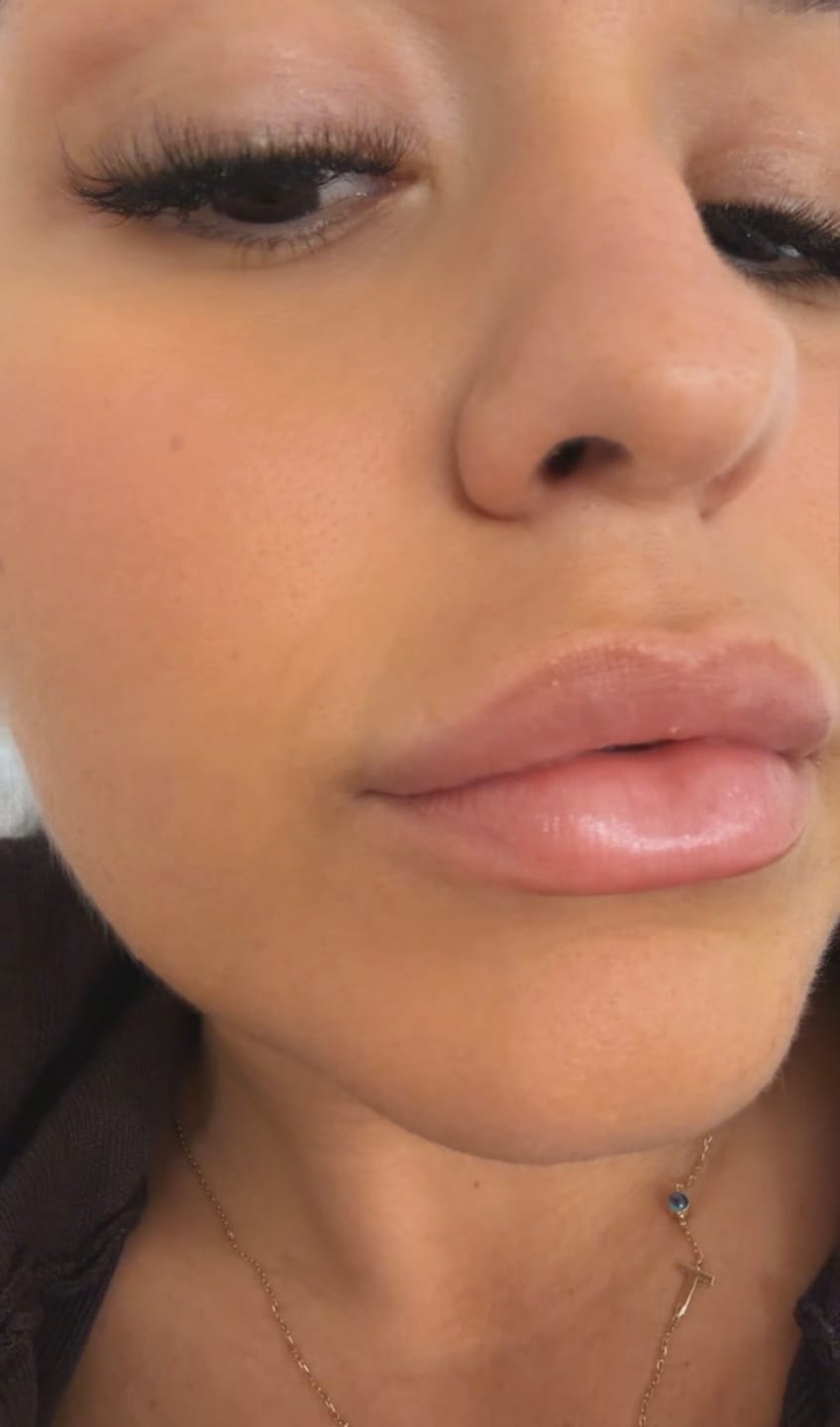 Customer photo review of Hydrate Luxe Lip Balm
