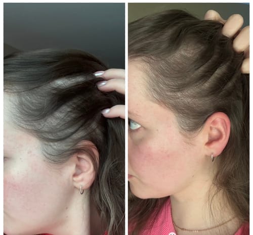 Customer photo review of Pre-Wash Scalp Oil by TR