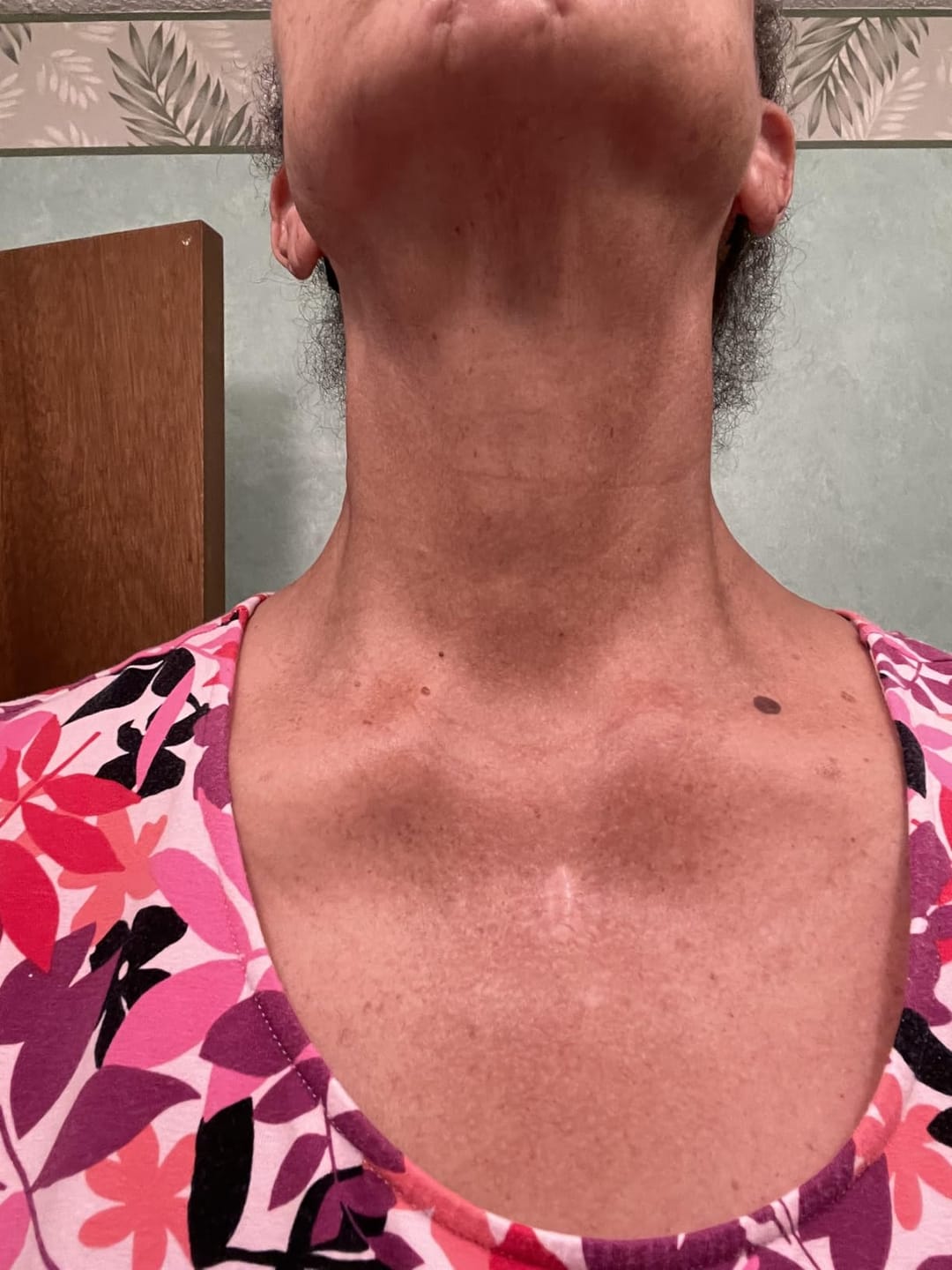 Customer photo review of NØRD BODY Peptide Body Oil