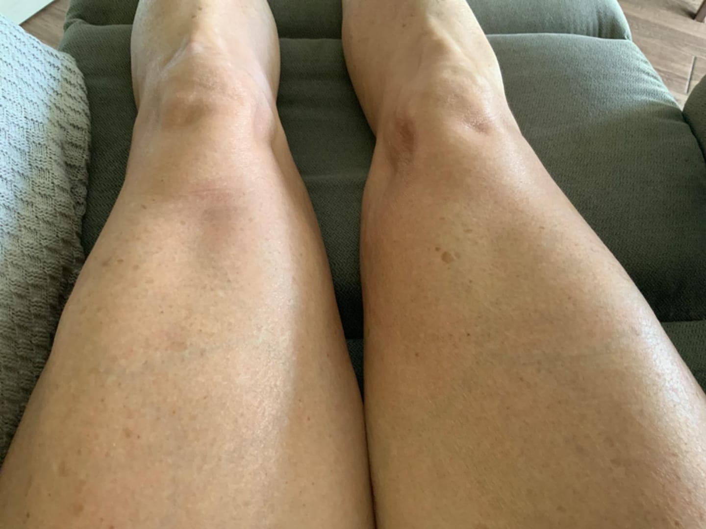 Customer photo review of NØRD BODY Peptide Body Oil