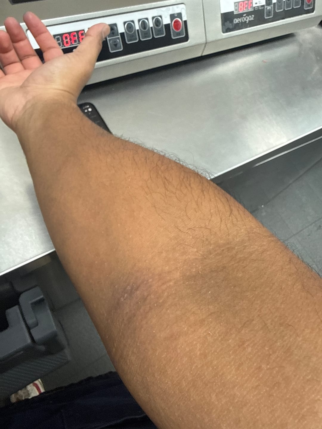 Customer photo review of Jolicare Cream