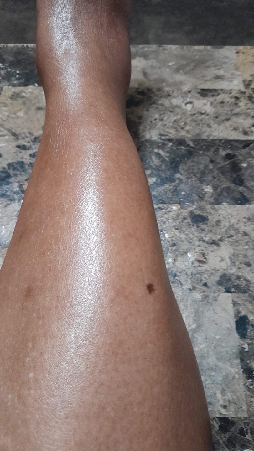 Customer photo review of NØRD BODY Peptide Body Oil