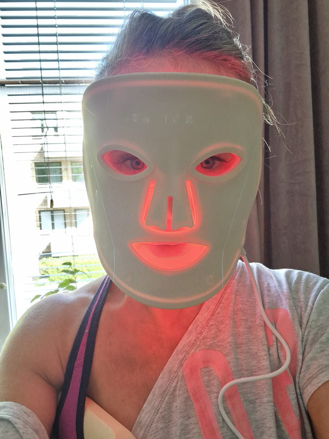 Customer photo review of Skinboosting LED mask